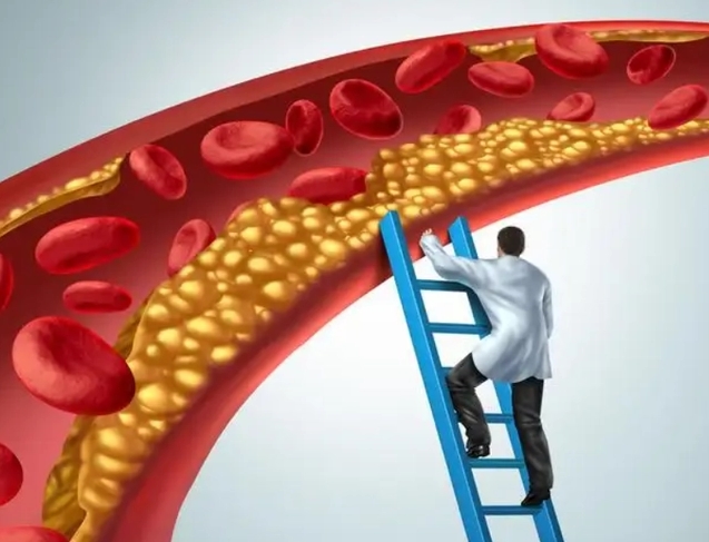 阿托伐他汀是治什么的?优选原研药、长期使用,有效降脂第一步(图2) 阿托伐他汀是治什么的?优选原研药、长期使用,有效降脂第一步(图2)